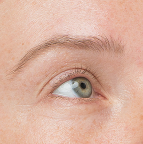 Before photo of a woman with sparse lashes and brows