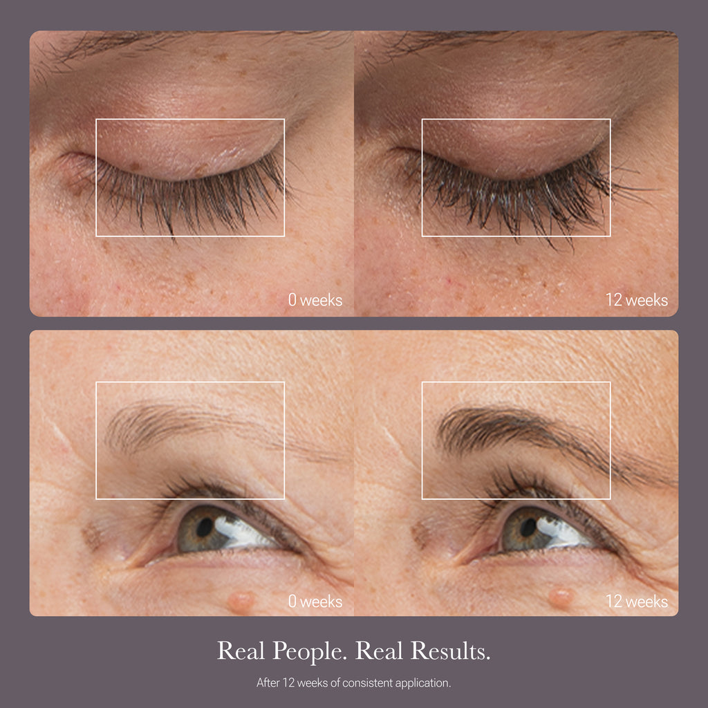 Before and after photos of a woman’s lashes and brows after using our Dual System for 12 weeks