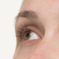 A woman's eye at week 0 before starting her Nulastin renewal journey