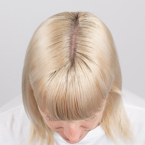 Thicker looking hair after 12 weeks using Nulastin Vibrant Scalp Treatment