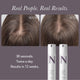 Solution Serum System
