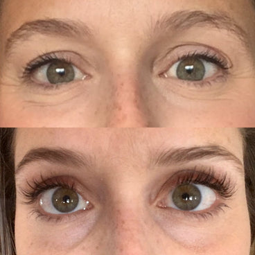Close-up of a person's eyes showing before-and-after lash results with sparse lashes above and fuller, longer lashes below
