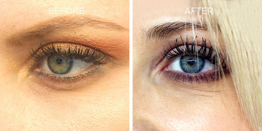 Split close-up of an eye labeled Before and After showing sparse lashes and brows before and fuller lashes and thicker brow