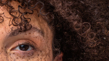 Close-up of left eye with freckles and dense brown curly hair showing hair texture