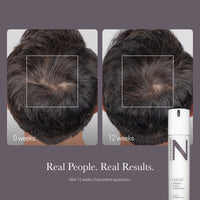 HAIR Vibrant Scalp Treatment