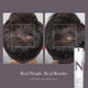 Before and after photos of a man’s head after using Scalp Treatment for 12 weeks