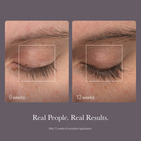 LASH Follicle Fortifying Serum 2-Pack