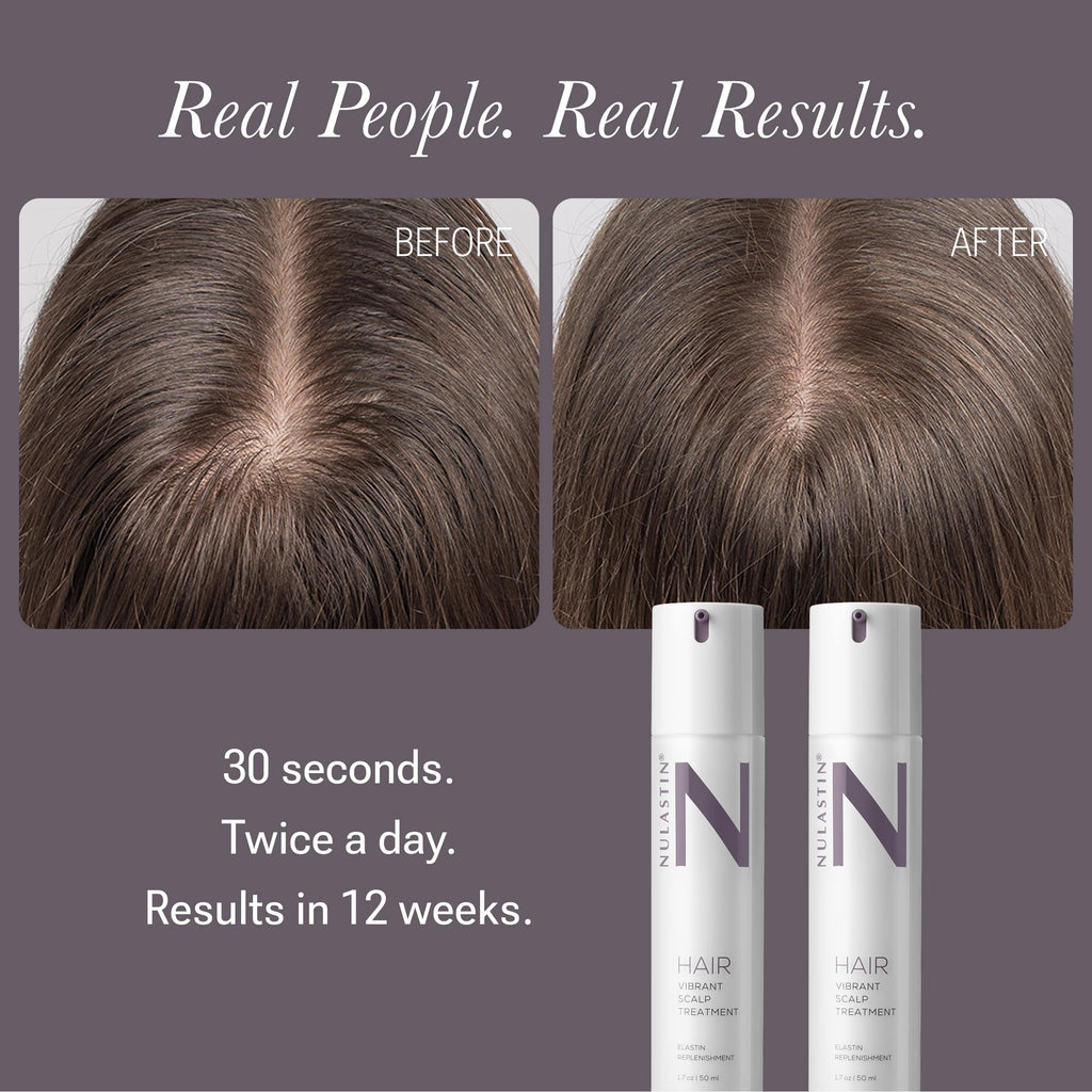 Solution Serum System