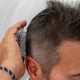 Man using Nulastin Stimulating Scalp Scrubber on back of scalp to invigorate follicles and encourage visible hair growth