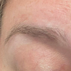 Sparse eyebrow at week 0