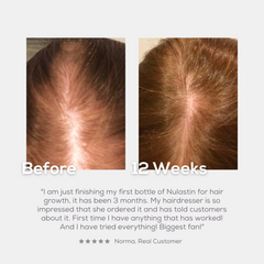 HAIR Vibrant Scalp Treatment with Elastaplex®